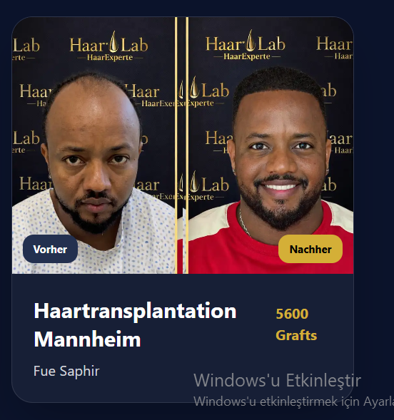 Vorher Nachher Ergebnis 3