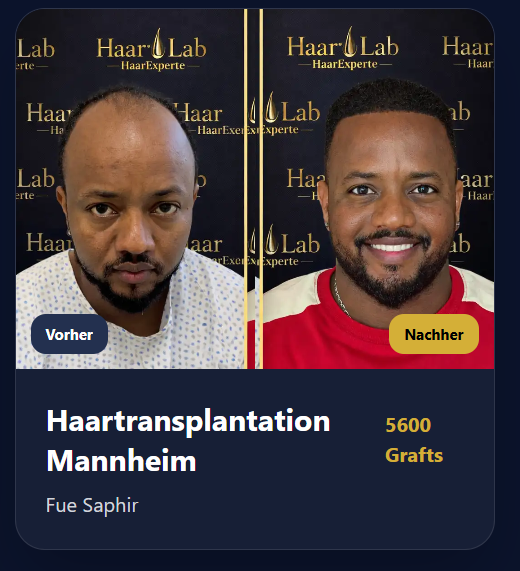 Vorher Nachher Ergebnis 4