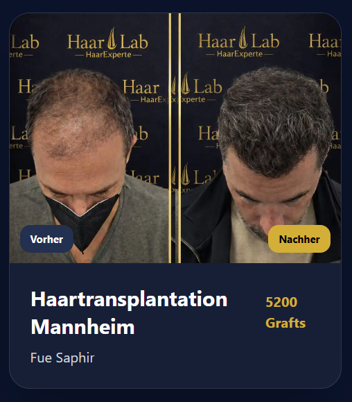 Vorher Nachher Ergebnis 6